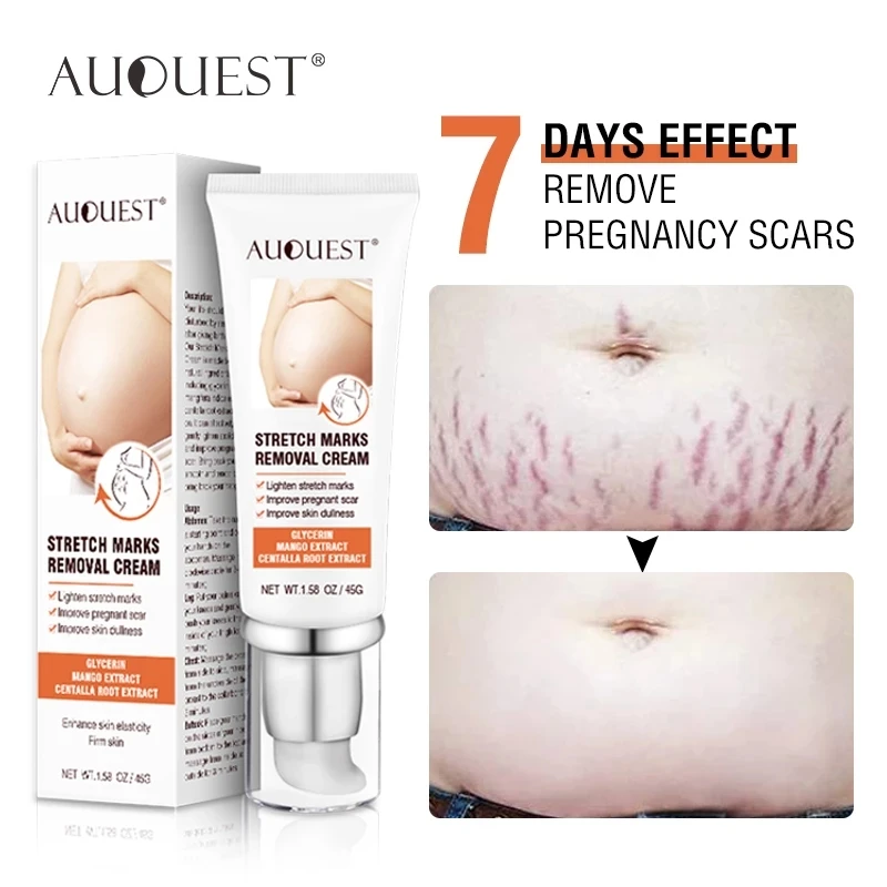 Permanent Women Stretch Marks Removal Buttock Breast Skin Care Pregnancy New Old Stretch Marks Cream For Maternity Body Care