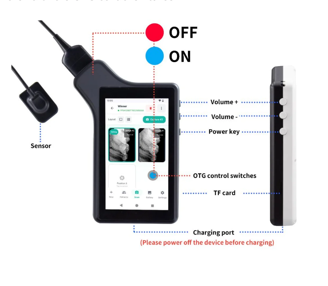 X-2026 Digital Dental Intraoral X-Ray Imaging System with Sensor & Display Screen DICOM PACS WiFi Image Management