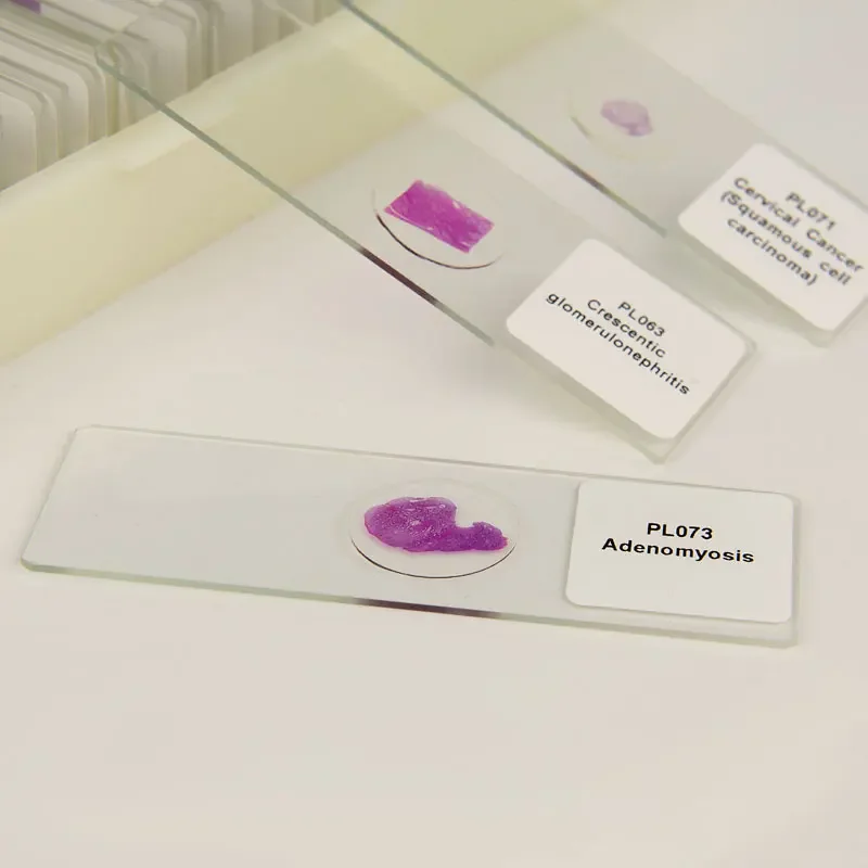 100 kinds Medical Pathological Sections of Human Body Typical Prepared Tissue Specimen Slides Microscope Glass Slice HE Staining