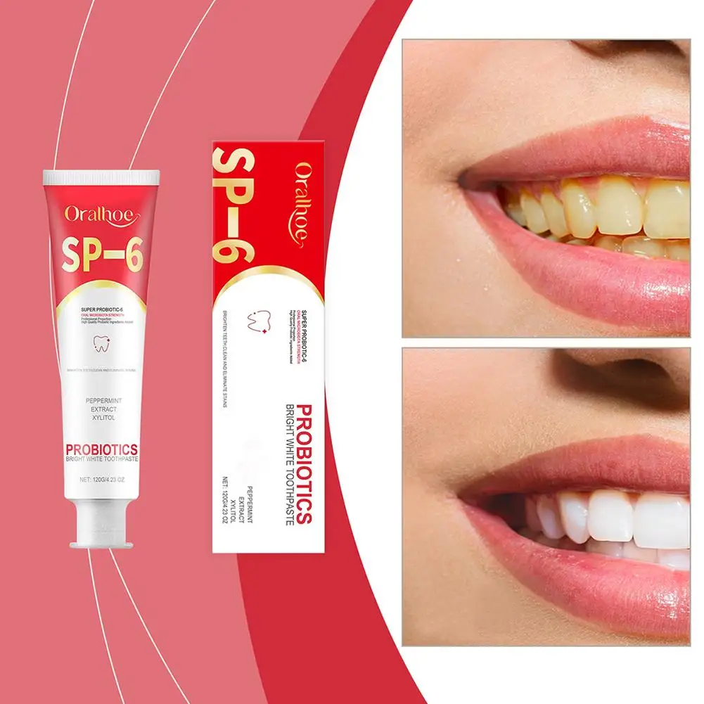 SP6 Probiótico branqueamento dentífrico, remoção mancha de dente impede, ferramentas de cuidado, reparar cavidades, dental, iluminar, fresco, B, A1M9