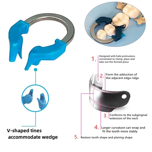 Imagen 2 del producto Bandas de matriz Dental NITI, anillo de abrazadera de matrices de Metal, sistema de matriz contorneada seccional, anillo de sujeción de titanio y níquel, herramientas de dentista