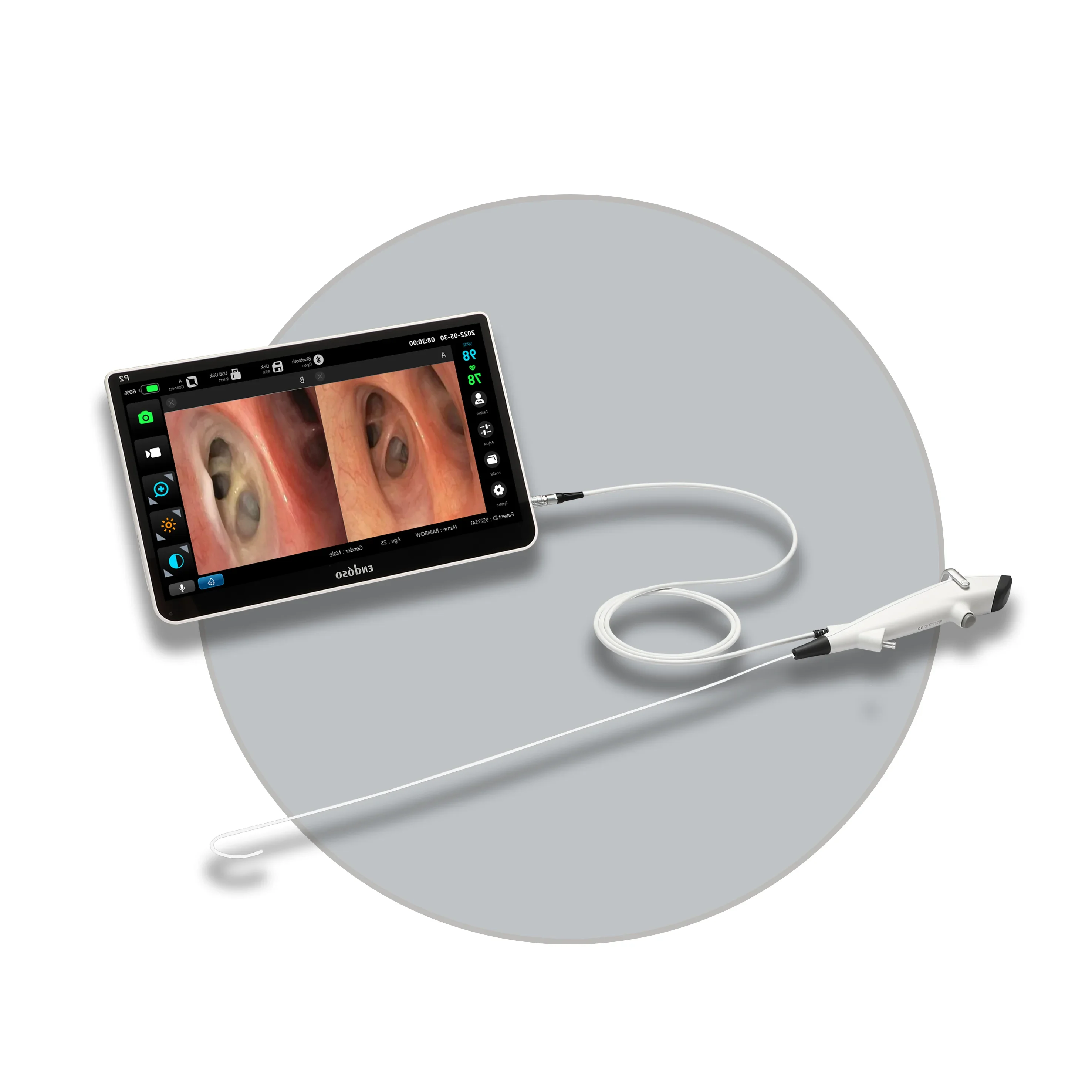 Endoso Wholesale 600MM Length Nasal Endoscope Single Use Digital Camera 2.8mm Flexible Bronchoscope For Endoscope