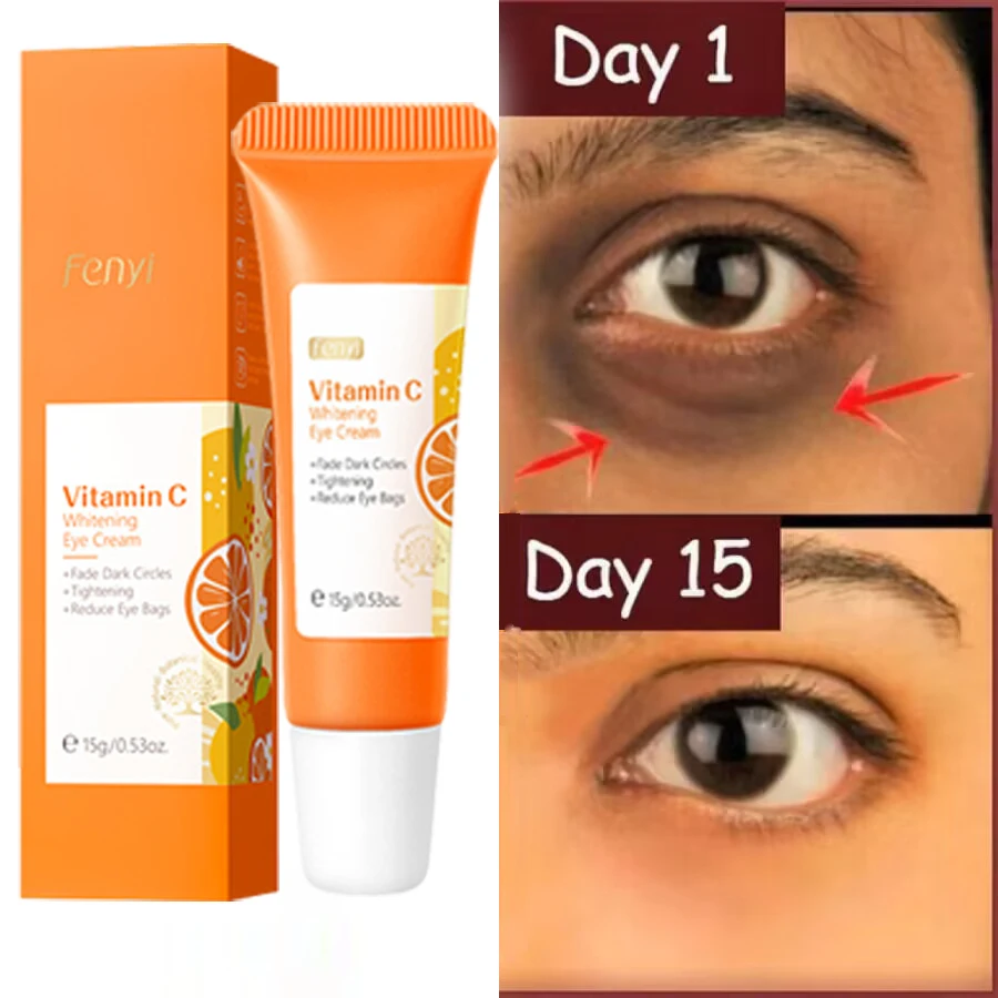 Vitamin C Anti-Dark Circles Eyes Cream Wrinkle Removal Fade Fine Line Anti Eye Bag Puffiness Serum Anti-Aging Lift Firm Eye Care