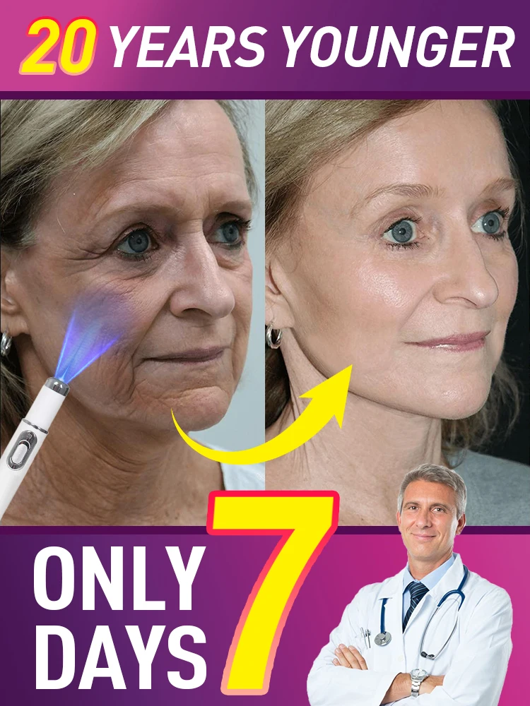 

Laser Product For Solves wrinkle Problems