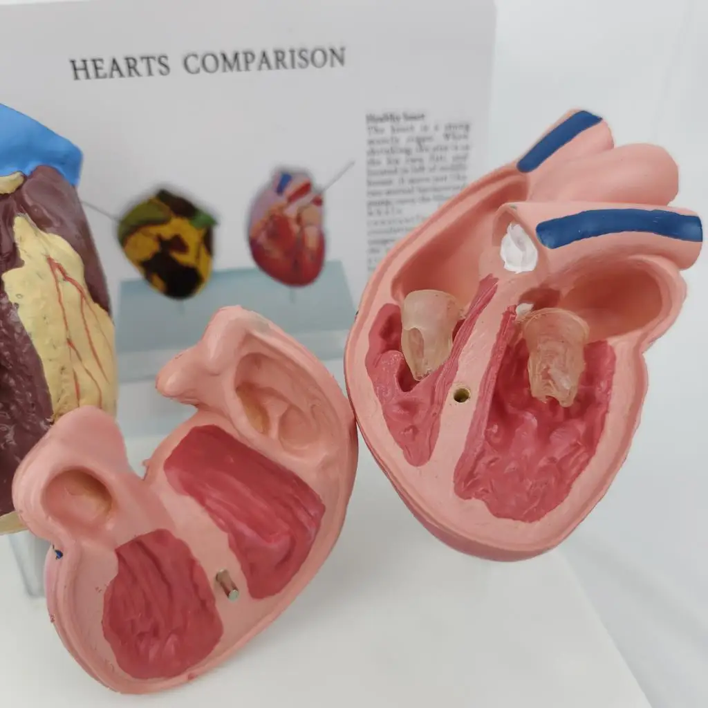 Human normal viscera smoking diseased organs contrast heart lung bladder blood vessels oral trachea fetus