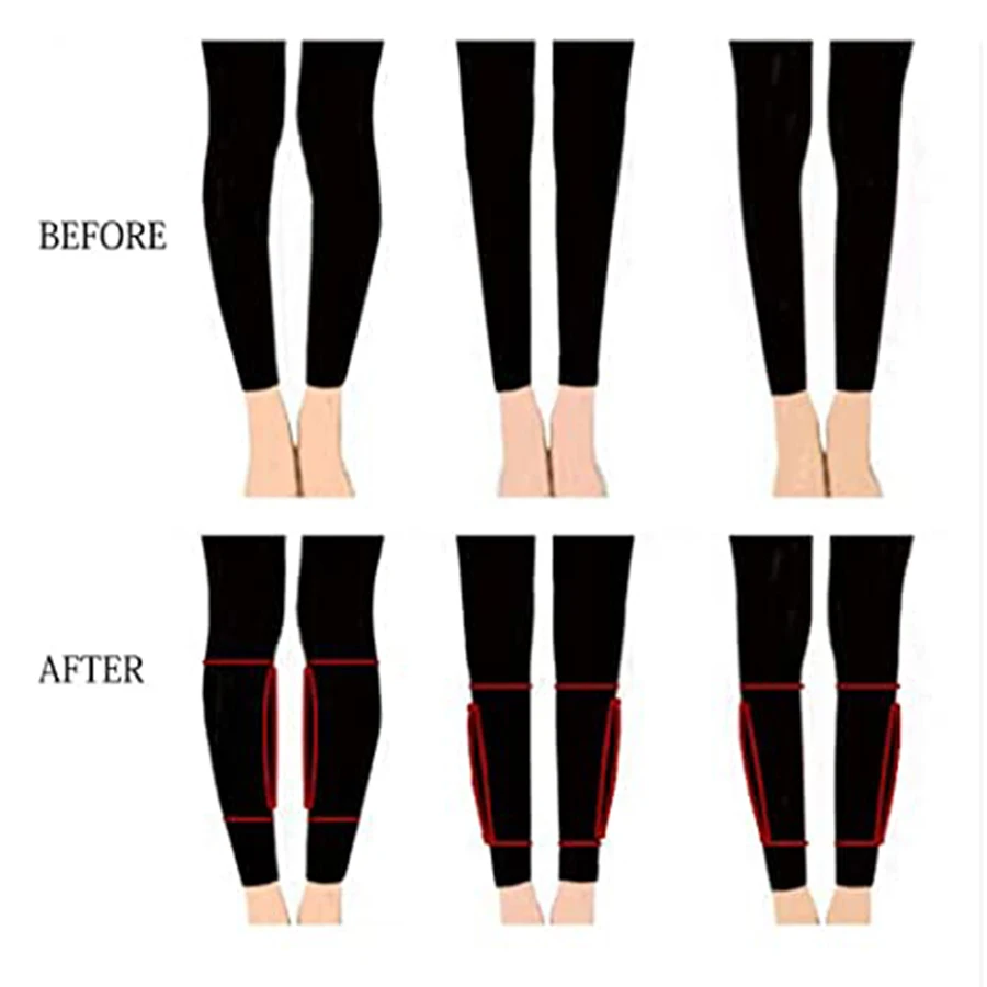 Realistic Onlays Silicone Leg Enhance Fake Calf Pads Arms Shaper Leg Correctors for Crooked or Thin Legs Covering Scars