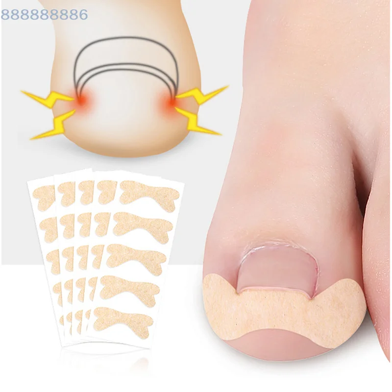 

[B]1sheet Ingrown Toe Foot Nail Correction Sticker Pedicure Toenail Corrector