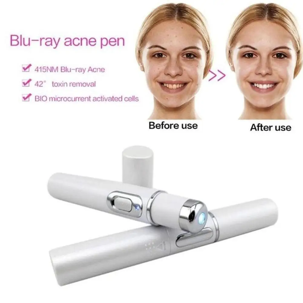 Blue Light Acne Removal Pen Eye Massager Eliminate Undereye Bags Fade Dark Circles Eye Massage Stick Face Beauty Tool Skin Care