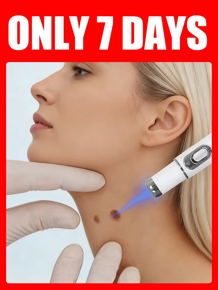 

Лазерный прибор для удаления бородавок 3-го поколения 2026 года – избавление от всех бородавок за 7 дней