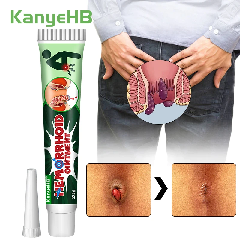 1Pcs Hemorrhoid Cream Remover Internal Piles Herbal Relieve Anal Pain Anus Swelling Bleeding Hemorrhoids Medical Ointment G042