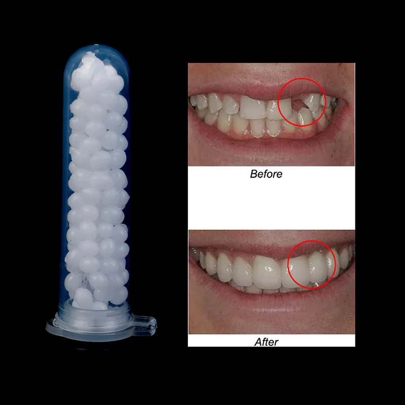 

New Temporary Tooth Repair Kit Teeth And Gaps False Teeth Solid Glue Denture Adhesive Teeth Whitening Resin Tooth Beauty Tool