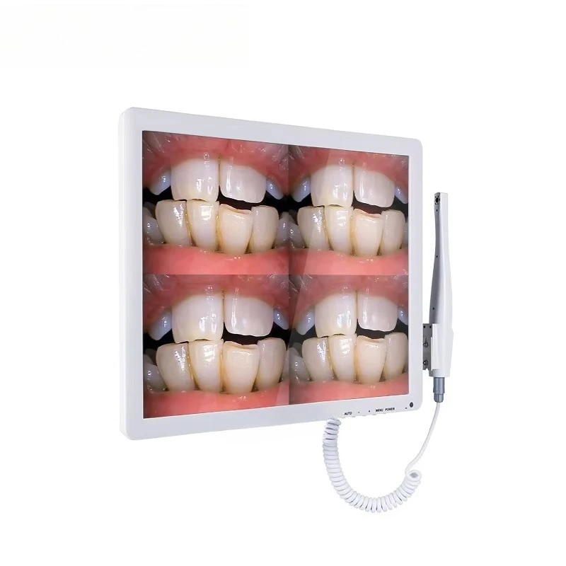 High Class White Intraoral Camera in Dentistry for Taking Picture
