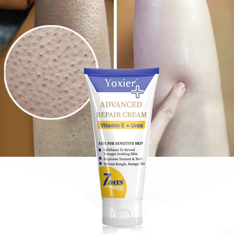 

Repair Moisturizing Cream Skin Care Moisturizing Nourishing Anti-drying Improving Rough Texture Removing Raised Vitamin E 50g