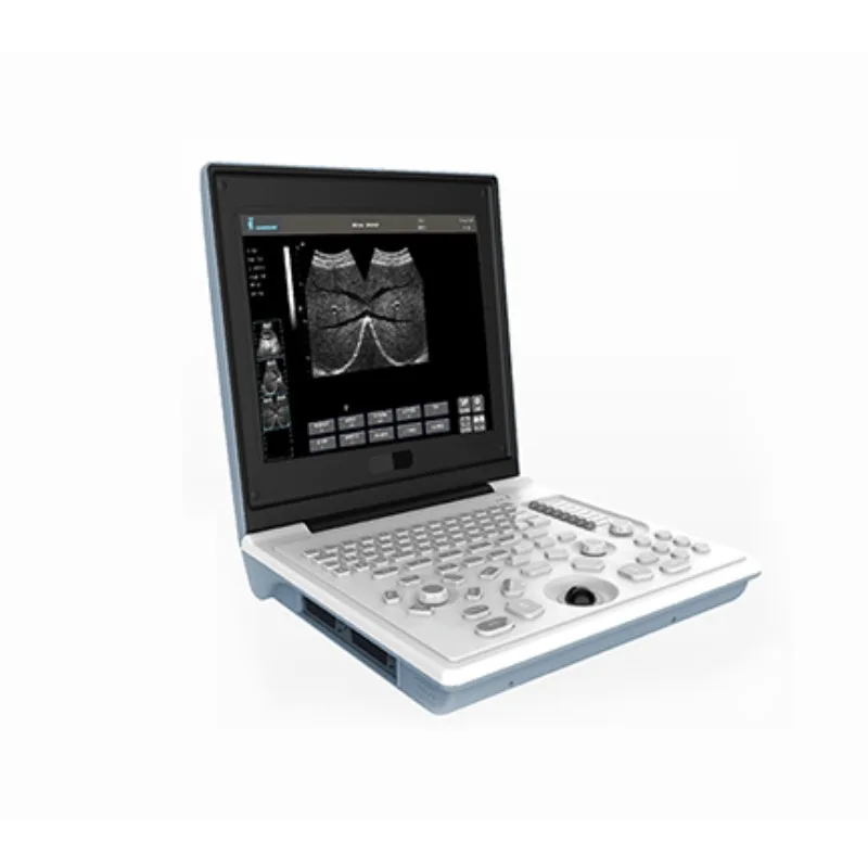 Full Digital LED Professional laptop type black white ultrasound scanner with good price