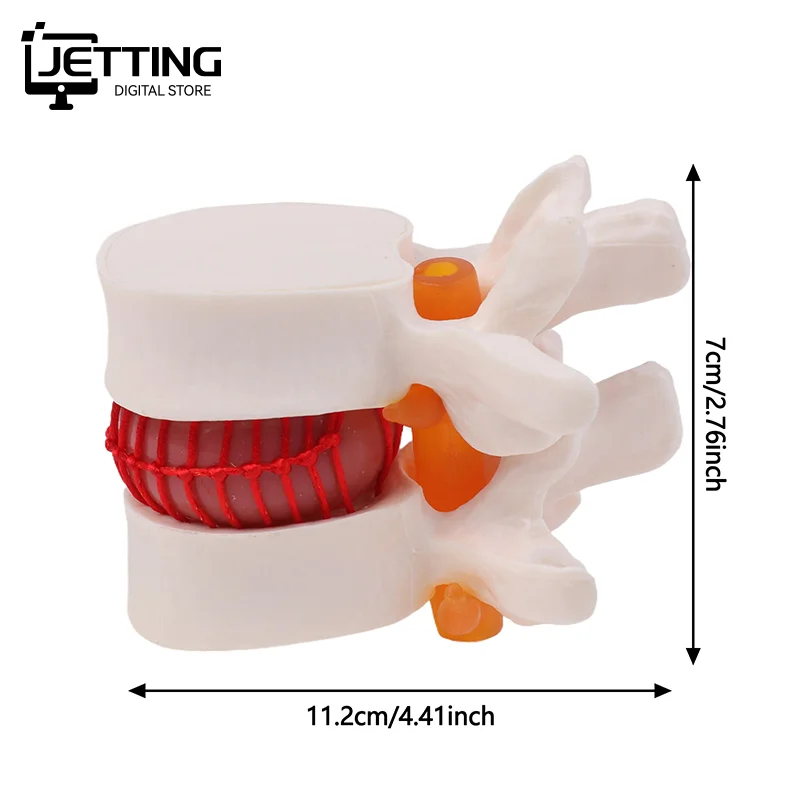 ✍ تشريح الإنسان الهيكل العظمي العمود الفقري قطني القرص فتق نموذج للتدريس الدماغ الجمجمة صدمة اللوازم المدرسية أداة طبية