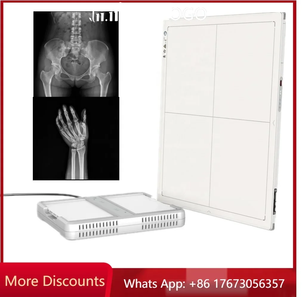 Hot Sell 14*17 Digital Wireless X-ray Flat Panel X Ray Detector For Vet Human Use MSLFP03