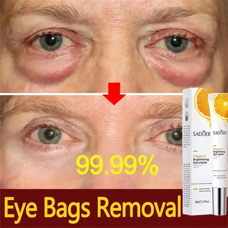 

Vitamin C Eye Cream Moisturizing Anti Dark Circles Eye Bags Firming Brightening Anti-puffiness Beauty Eyes Skin Care Products