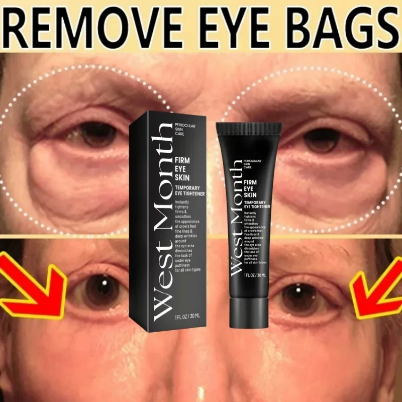

Eye Bags Cream Instant Removes Dark Circles Tightens The Eyes Lifting Firming And Removing Eye Bags Make Your Eyes More Lively