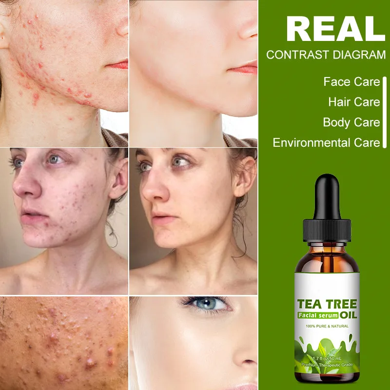 

Tea Tree Essential Oil Plant Oil Control Acne Moisturizer Whitening Anti-aging Anti-wrinkle Skin Evitalizer Organi Skin Care