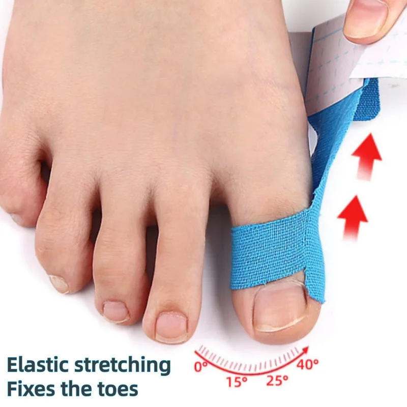 20Pcs Bunion Corrector Orthopedic Bunion Strap Breathable Toe Separator Hallux Valgus Orthosis Corrector for Big Toe Correction