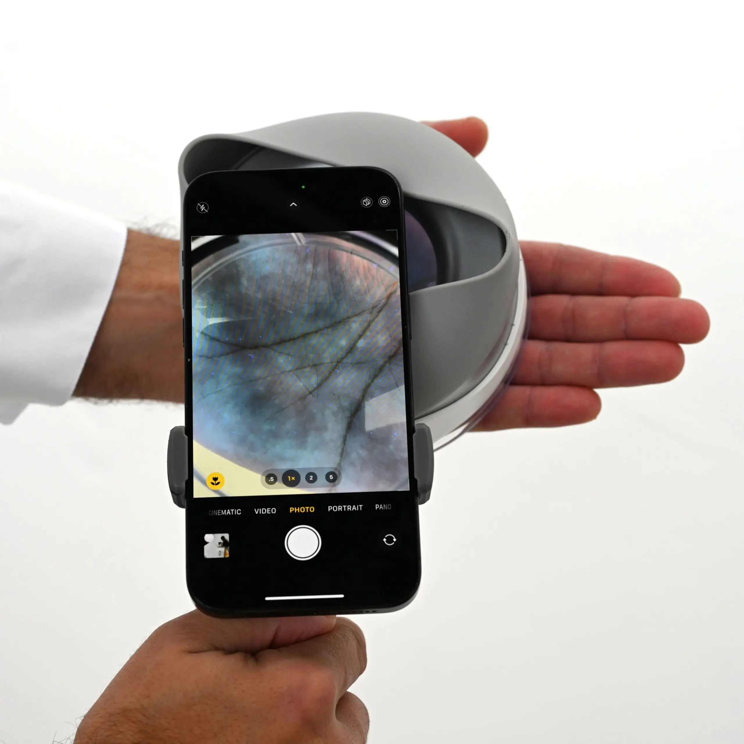 110 فولت-240 فولت مصباح وودز لطب الجلد بالأشعة فوق البنفسجية قابل لإعادة الشحن لامتحانات الكفة المصطبغة بصيلات أمراض الفطريات، بصيلات