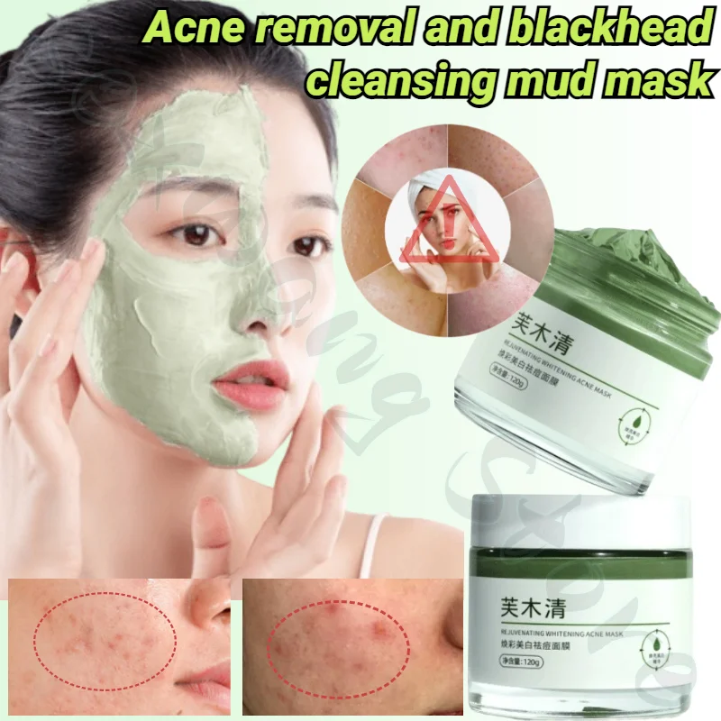 120g Anti-acne, Blackheads, Cleansing Mud Mask, Deep Cleansing Skin, Oil Control, Unclog Pores and Grease Mask