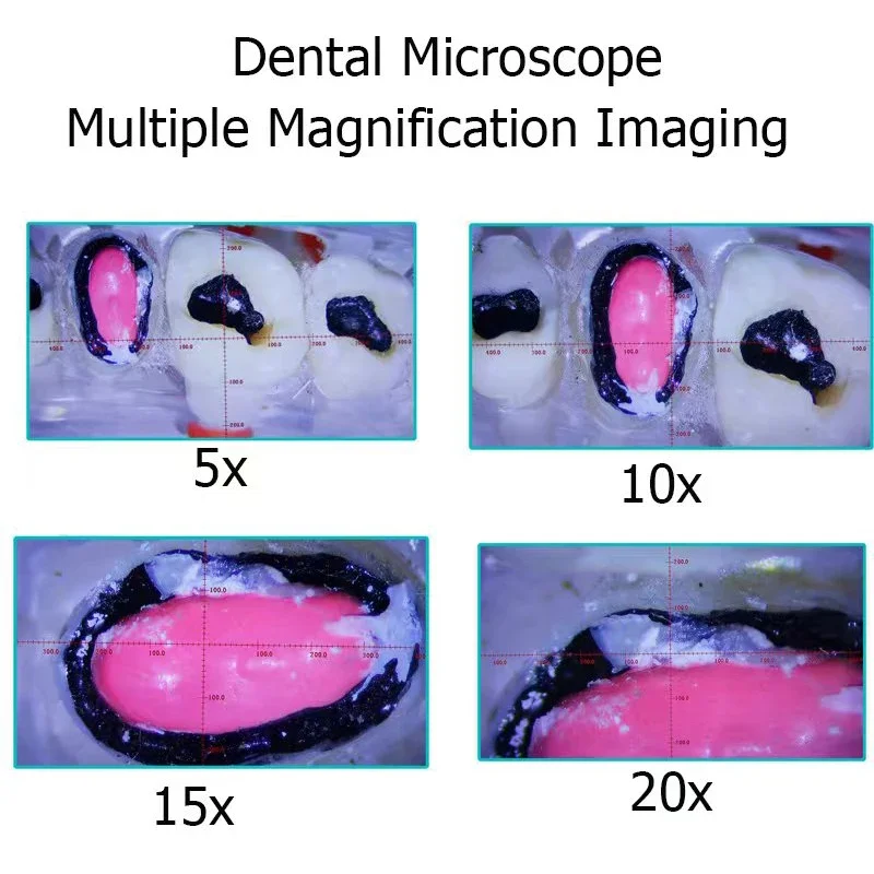 China Dental Operating Microscope Endodontie oral Stereo Dental digital lap Microscope with camera