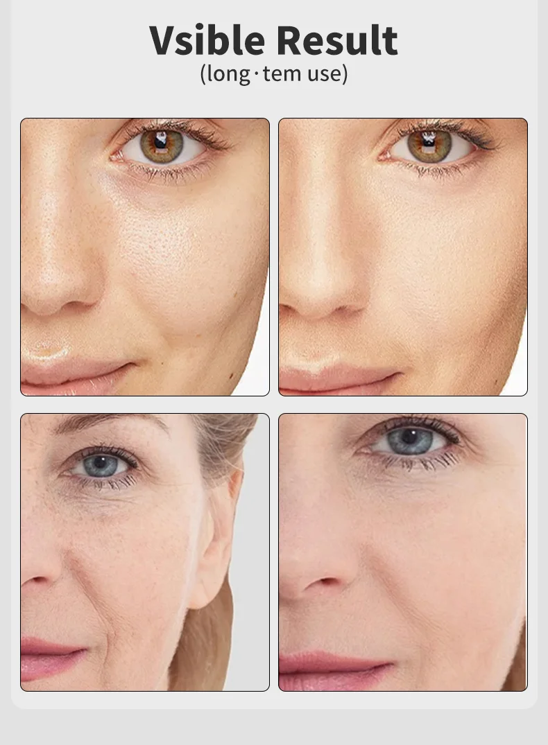 EMS Mikrostrom Gesichtspflege 7 Farben Age-R Booster Pro EMS Anti-Falten Schönheitsgerät Lifting-Massagegerät für den Heimgebrauch Hautpflege – Detail 8