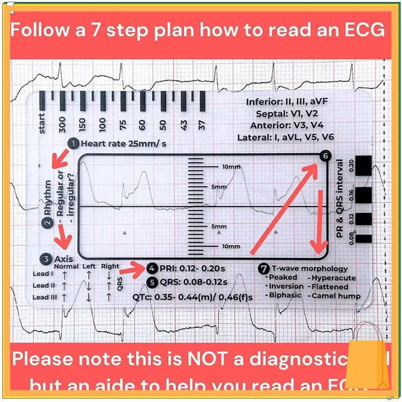 L52A-ECG 7-шаговая линейка, шаговая линейка ЭКГ 7-шаговая линейка для тердавления ЭКГ/ЭКГ, инструмент для быстрого и быстрого анализа кардиологии и измерения