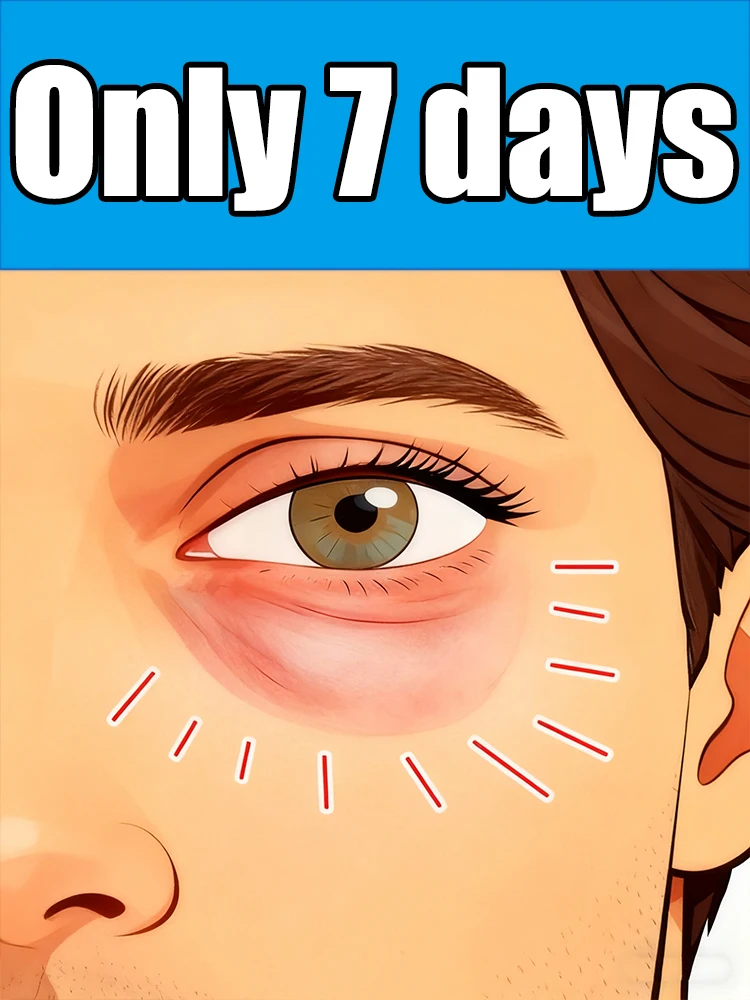 أدوات العناية بالعين، شحن مجاني، تدليك يحل مشاكل مختلفة، وصول جديد لعام 2025، أثرًا سلسًا للوقت