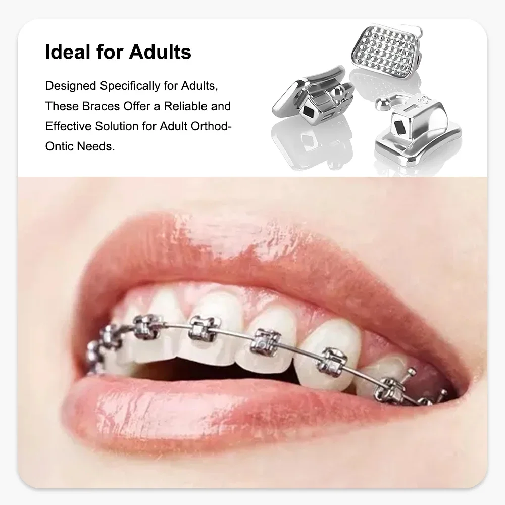 200Pcs Dental Ortho…