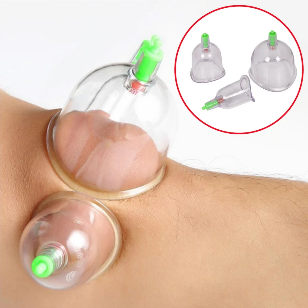 

Chinese Cupping Kangzhu U Curved Vacuum Cupping Suction Joint 3 Cup Cupping Therapy Joints Cups Traditional Acupuncture Massage