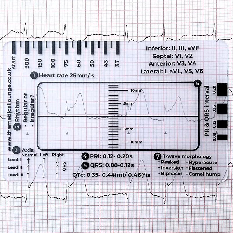 Ecg Ruler 7 Steps Electrocardiogram/electrocardiogram Ecg/ekg Assessment Tool Ruler Evaluation Plastic Transparent 8.5 * 5.4cm