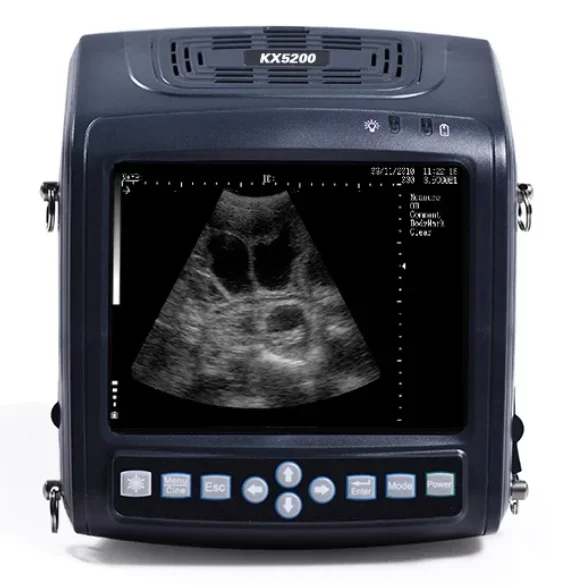 Ve-te Instrument Pre-gna Sc-an Ultra Machine Equipment for Enhanced Diagnostic Accuracy