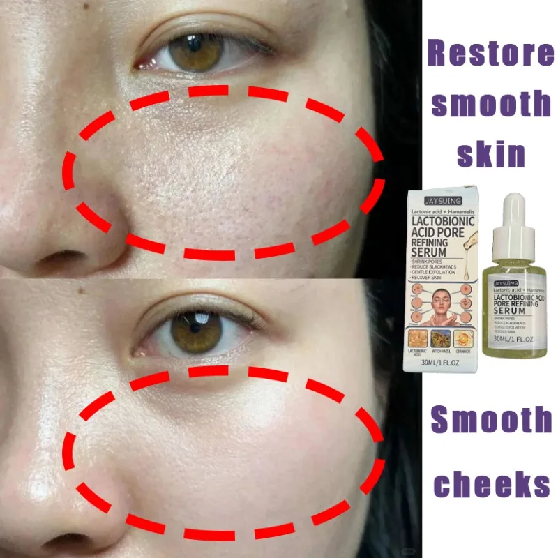 

Skin Texture | Pore Refining Resurfacing Powerful Pore Shrinking Serum for Tightening and Removing Large Pores on The Face