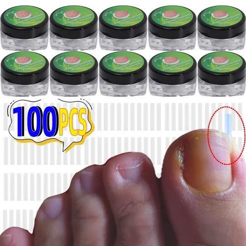 10-100 Uds. Corrector de uñas encarnadas, tubo Invisible, parches elásticos para dedos de los pies, Clip alisador, tratamiento de uñas de los pies, pedicura