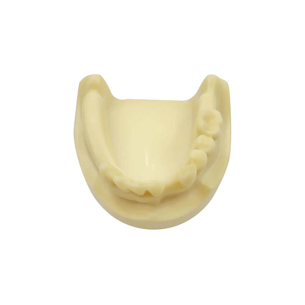 Dental Implant Training Model Lower Jaw Model With Missing Teeth Dental Studying Teaching Practice Typodont Dentistry Products