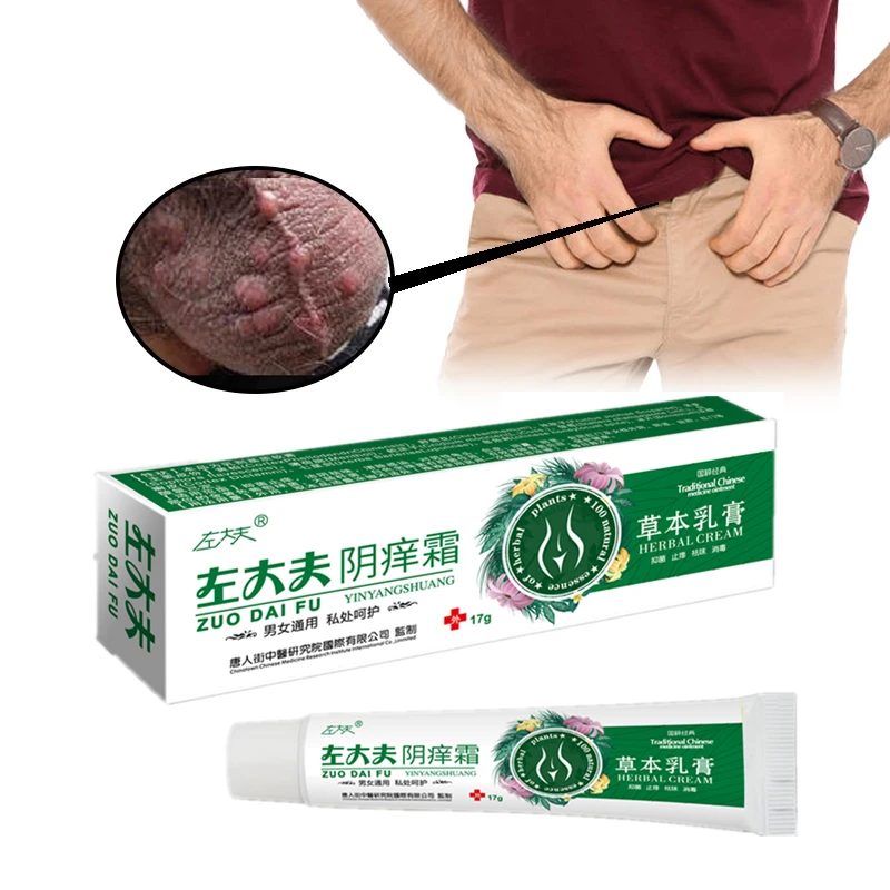 مضاد للجراثيم كريم الأكزيما مرهم إزالة رائحة الجزء الخاص التهاب الجلد المضادة للحكة Tinea Cruris عشب الجلد الطبي الصدفية كريم