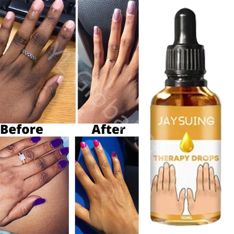 

Dark Knuckles Fast Brighten Serum Elbows Hand Knuckle Brightening Serum Knee Black Skin Quickly Lighten Stains Remover Essence