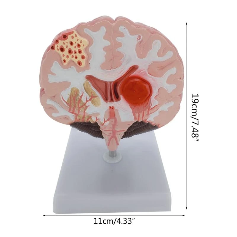 نموذج تشريحي للدماغ مع شرايين جذع الدماغ والقشرة الدماغية وما إلى ذلك من المحاضرات تستخدم أفضل المبيعات
