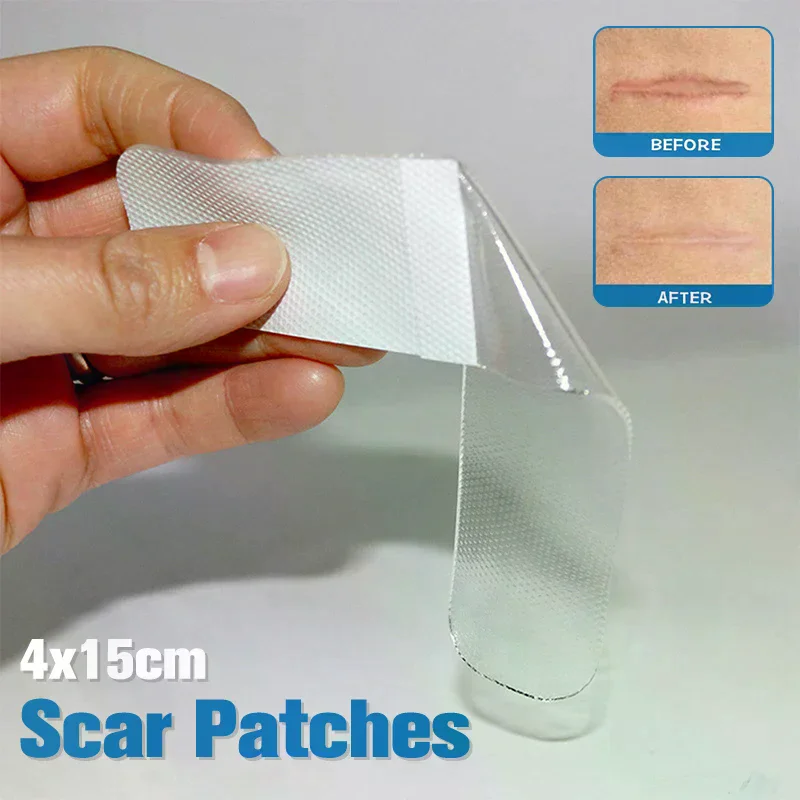 4x15cm Scar Patches Remove Silicone Gel Sheet Patch Ear Correctors Burn Wounds Efficient Surgery Tape Skin Repair Accessory