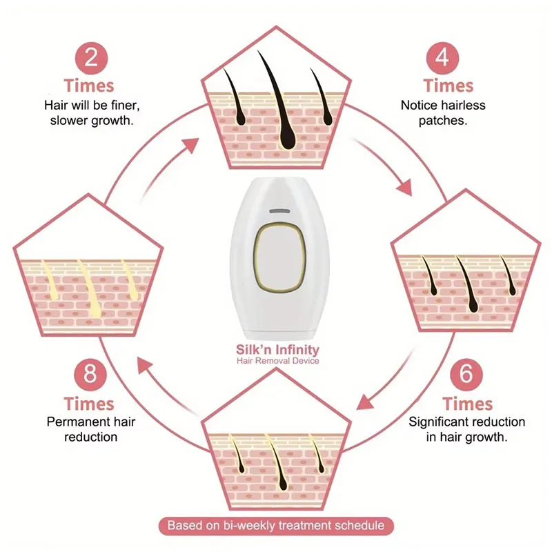 جهاز إزالة الجلد والفوتون بالليزر لجميع أفراد الجسم، جهاز إزالة الشعر غير المؤلم للرجال والنساء