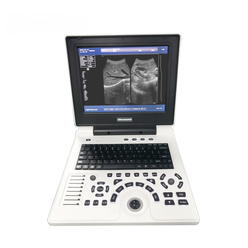 12 Inch LED Laptop Portable B Ultrasound Scanner Echo Machine Full Digital Diagnostic System