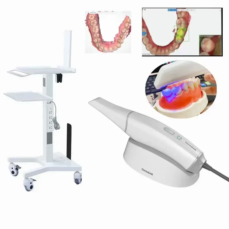 Scanner Cart Tool Cart with Bracket Tray Hoder Mobile Workstation