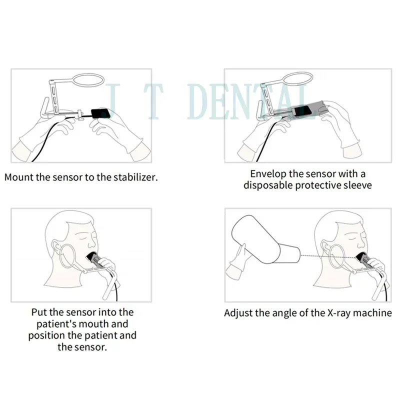 Lightweight and Durable Dental X-ray Sensor Holder: Easy Operation, Cost-Effective Design, and Precise Digital Sensor Locator