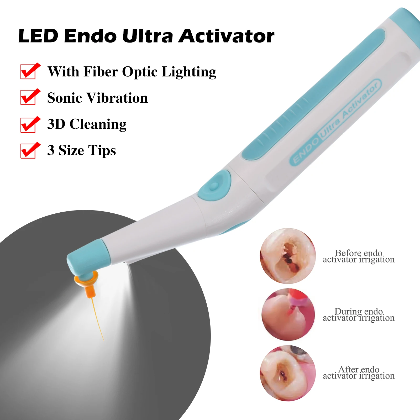 Dental Endodontic Endo Ultra Activator Handpiece LED Light Root Canal With 150 Sonic Irrigator Tips  Dentistry Instrument Tools view 3