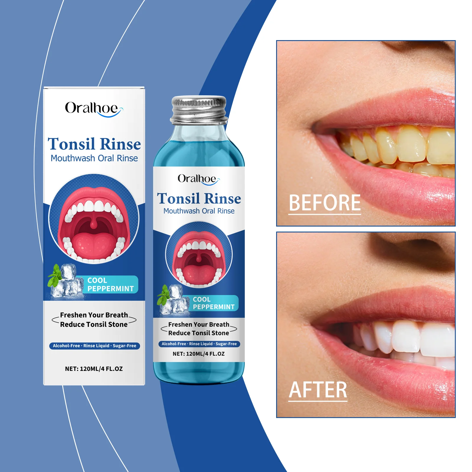 Oralhoe Bain de bouche Blanchiment des dents Nettoyage des gencives
