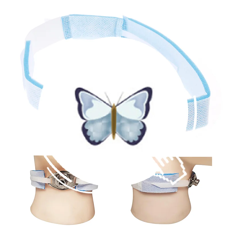 

1X поддержка шеи, устройство для фиксации эндотрахеальной трубки, фиксированный держатель ремня для трахеостомы