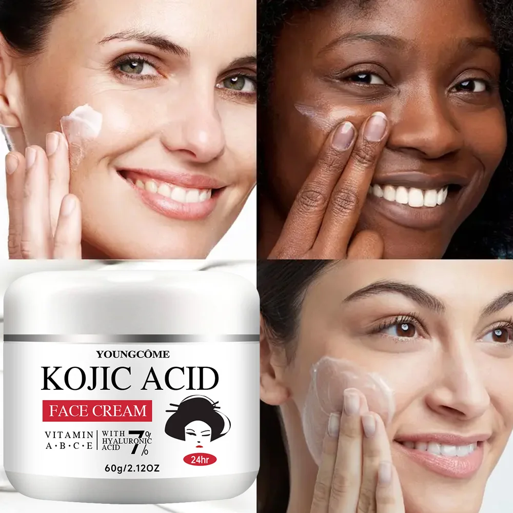 YOUNGCOME Kojisäure-Serum und Cremebundle – Aufhellendes Set für dunkle Flecken, Aknenarben, Anti-Aging, gleicht den Hautton ab, 2-in-1-Hautwagen – Detail 9