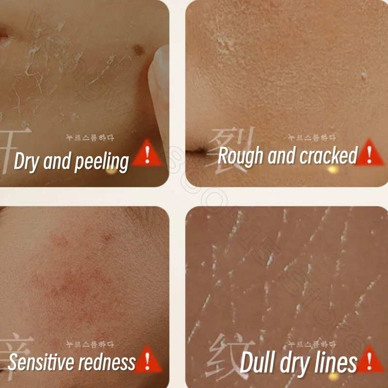 Crème provitamine B5 300G, réparation hydratante, sensible, rafraîchissante, Non grasse, automne et hiver